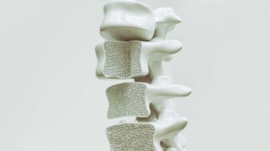 Osteoporoza kręgosłup